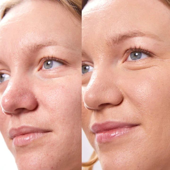 Concealer Balm Nr. 4.75 Cashew Vorher-Nachher - semi-mattes Finish für natürlichen Look