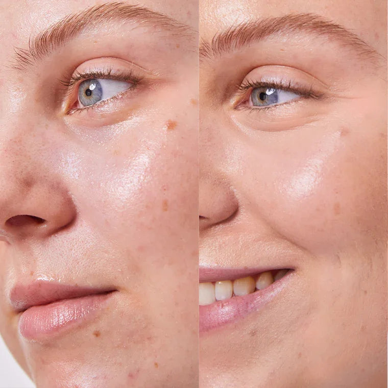 Concealer Balm Nr. 4.5 Seashell Vorher-Nachher - natürliche Abdeckung für alle Hauttypen