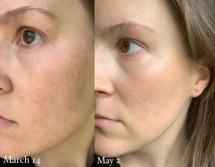 Holifrog Sunnyside C Glow Serum - Vorher Nachher Vergleich