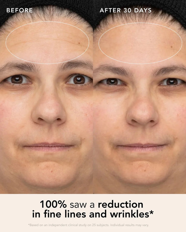 Vorher-Nachher-Bild mit sichtbar glatter wirkender Haut nach Ranavat Firming Bakuchi Serum