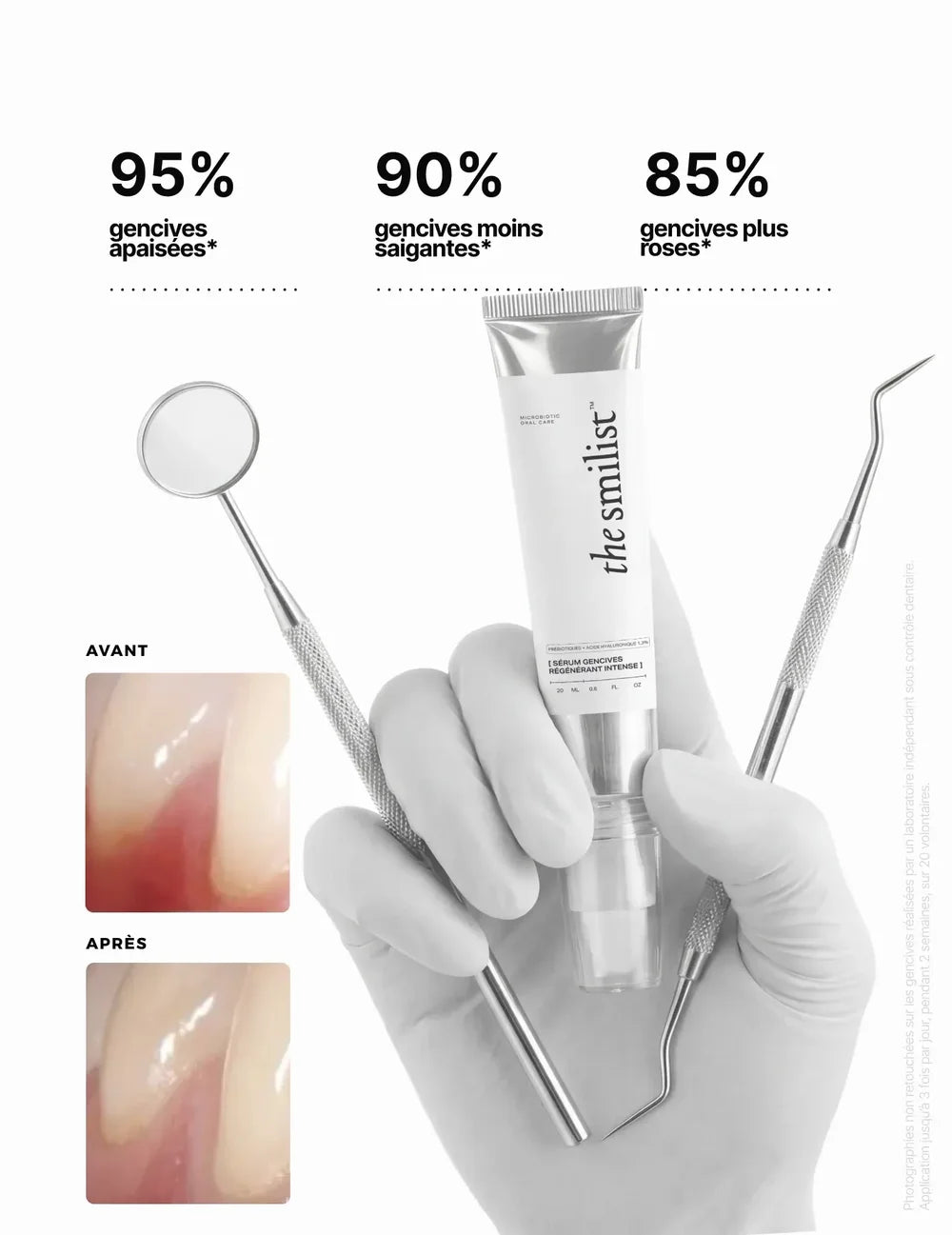 Intense Regenerating Gum Serum von The Smilist - vorher / nachher, in Hand gehalten, Studienergebnisse