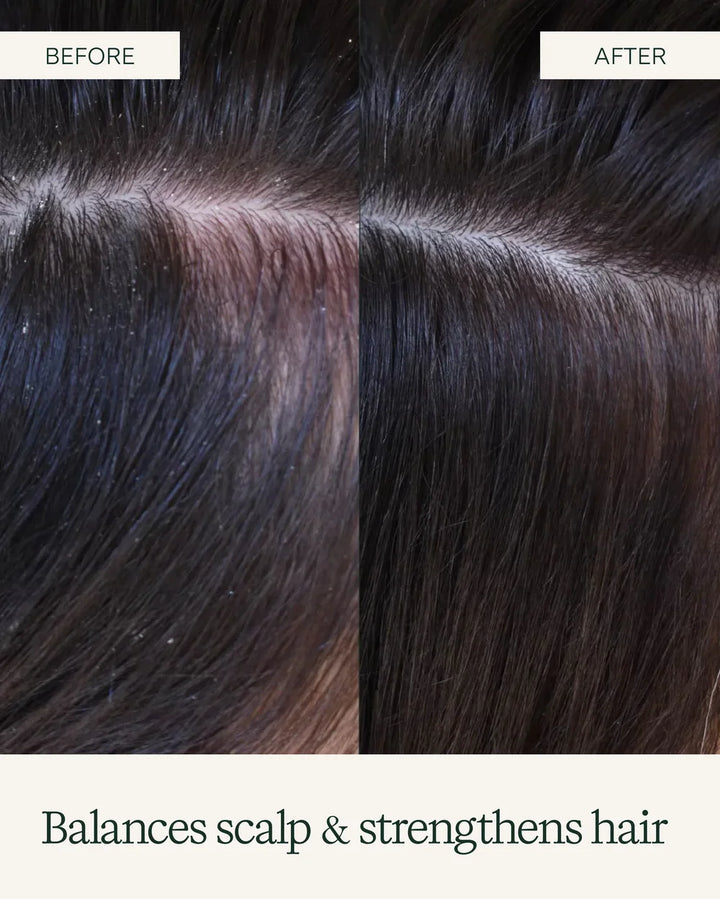 Nahaufnahme der Kopfhaut nach der Anwendung von Rahua Scalp Exfoliating Shampoo