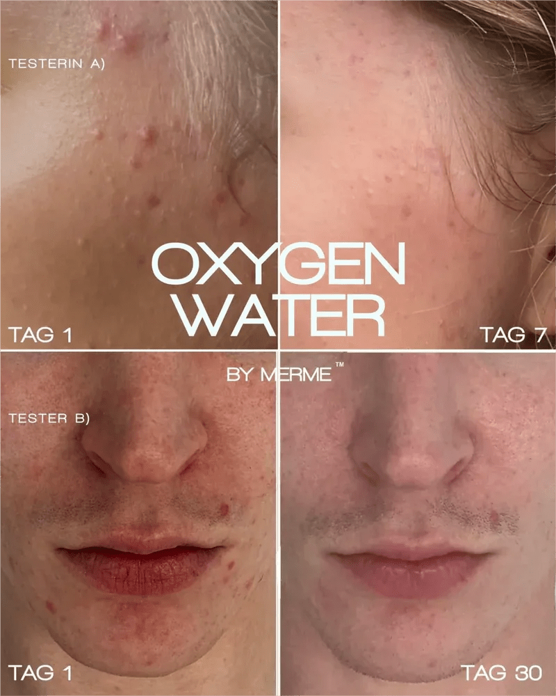Oxygen Water - es wirkt