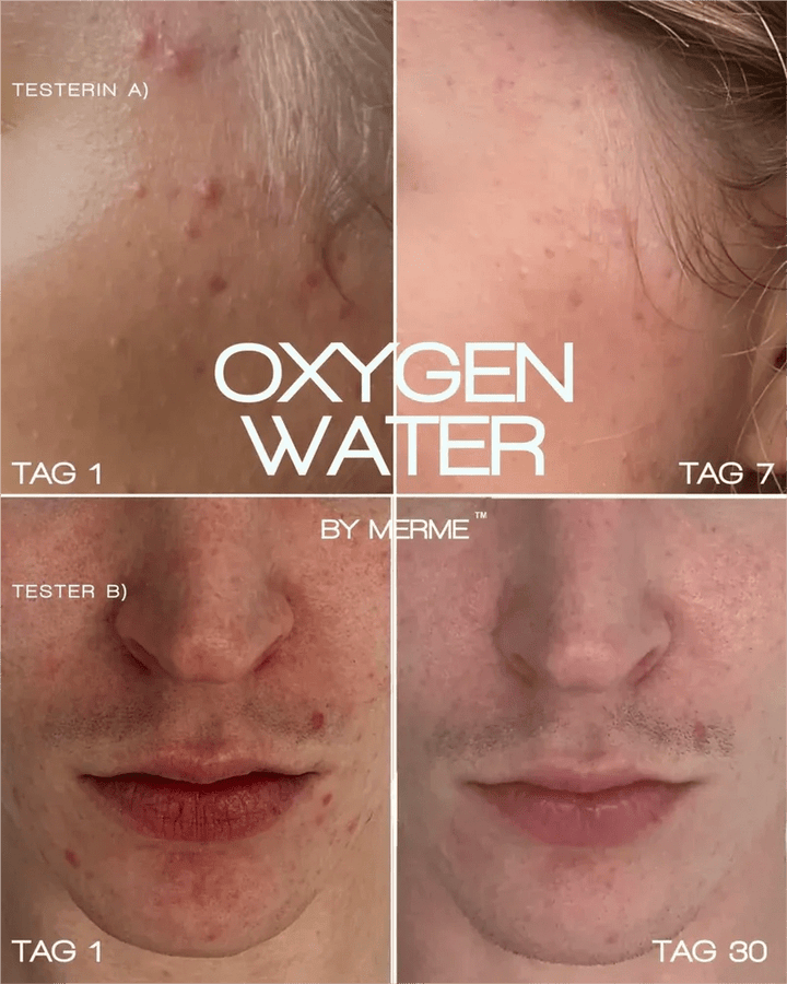 Oxygen Water - es wirkt