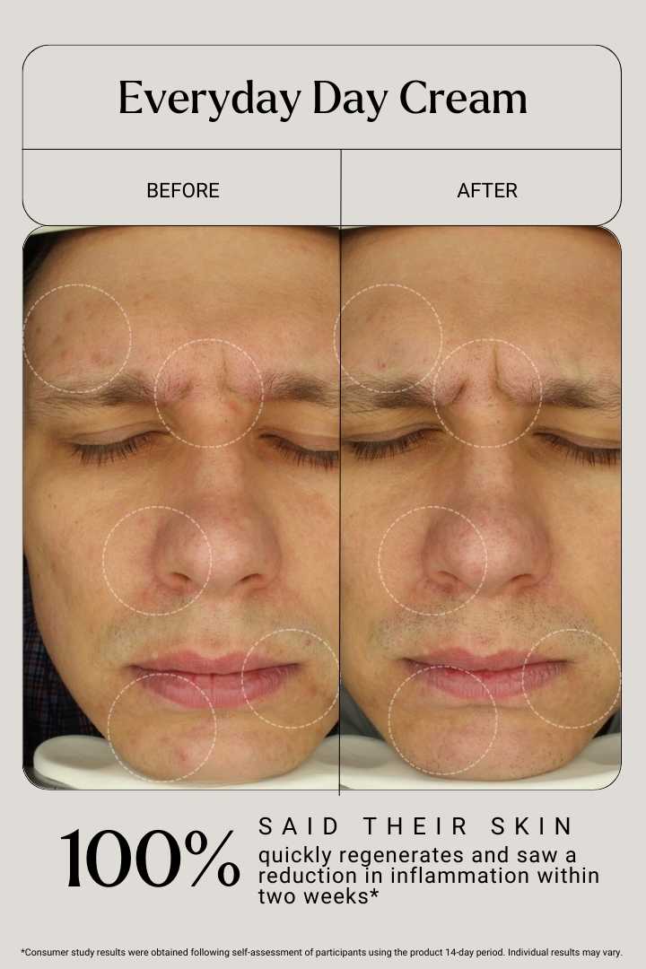 Naya Everyday Day Cream - Before After