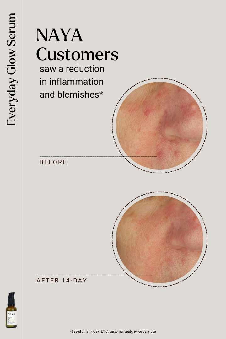 Naya Everyday Glow Serum Before After