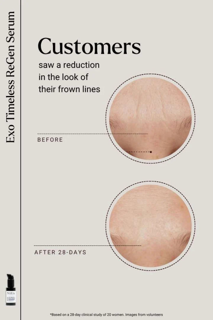 Exosomen Serum Resultate