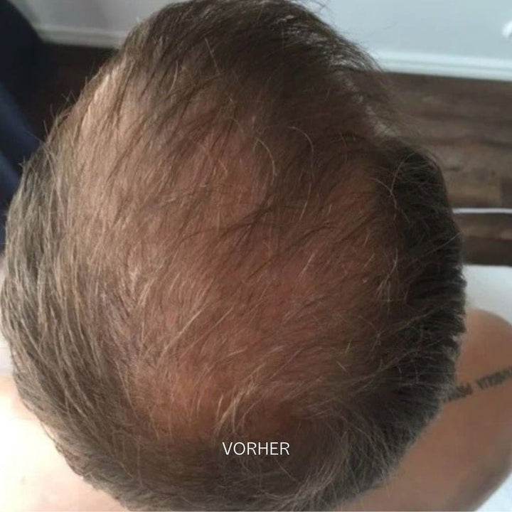 Grow & Shine Scalp Treatment Essence Vorher