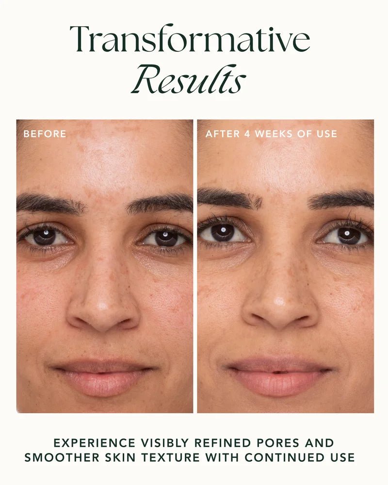 Refining Lotus Gel-Crème Results