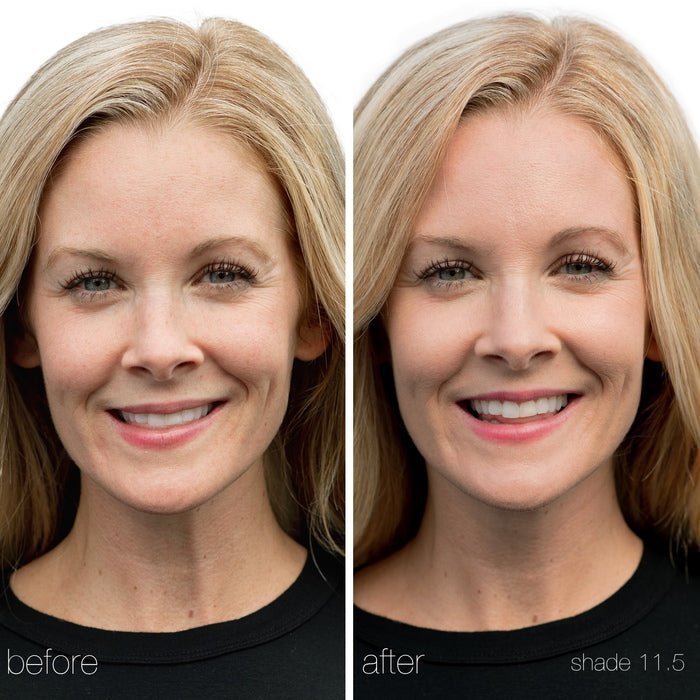 Un Cover-up Concealer 11,5  - Before and After