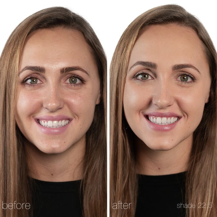 Un Cover-up Concealer22,5 - Before and After